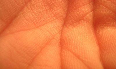 пластический