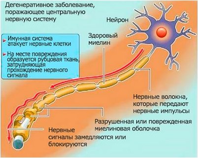 токсин