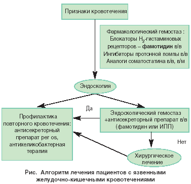 Исследование выявляет отдельный тип распространенного желудочно-кишечного кровотечения