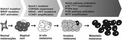 РНК-регулятор меланомы может стать новой мишенью для лечения рака