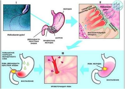 случае если