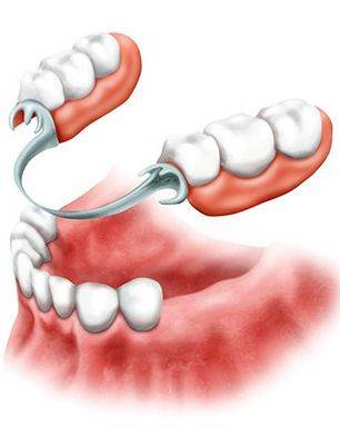 протезирование