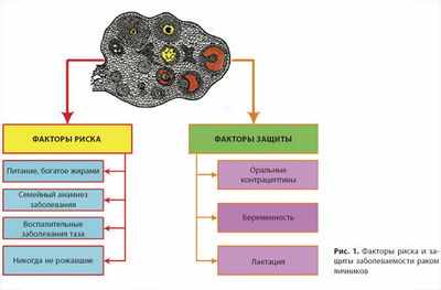 Раскрытие механизмов, поддерживающих распространение рака яичников