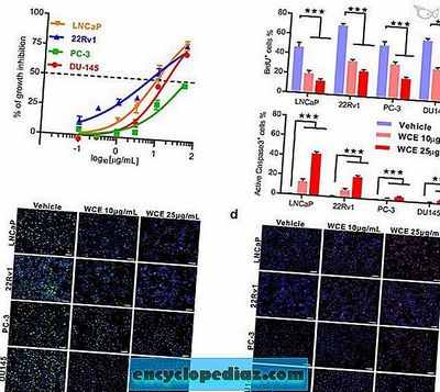 Блокирование действия клеток, вызывающих воспаление, снижает инвазию клеток рака простаты